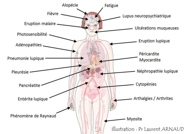 Lire la suite à propos de l’article AUTO IMMUNITE ET ALLERGIES : Quand ton immunité devient le voisin relou du quartier